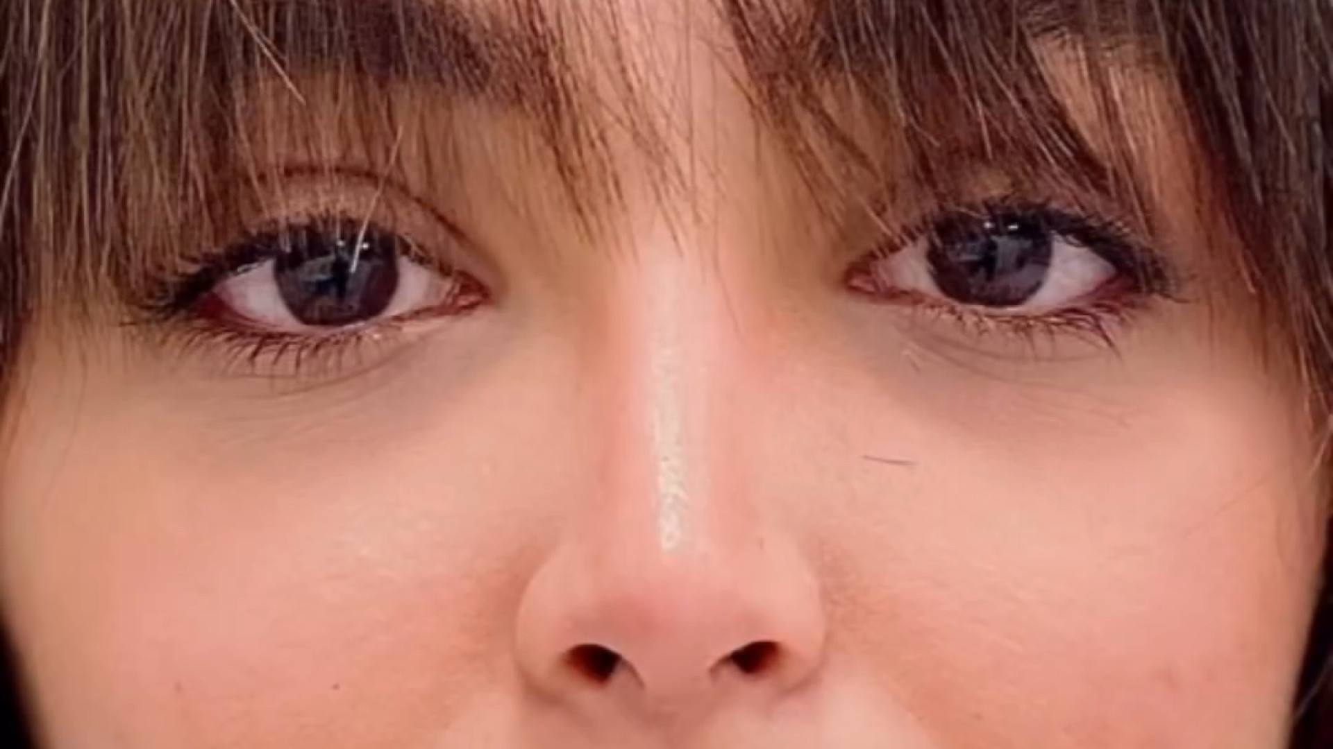 جراحی زیبایی توسط دکتر مفرد دکتر حمیدرضا مفرد