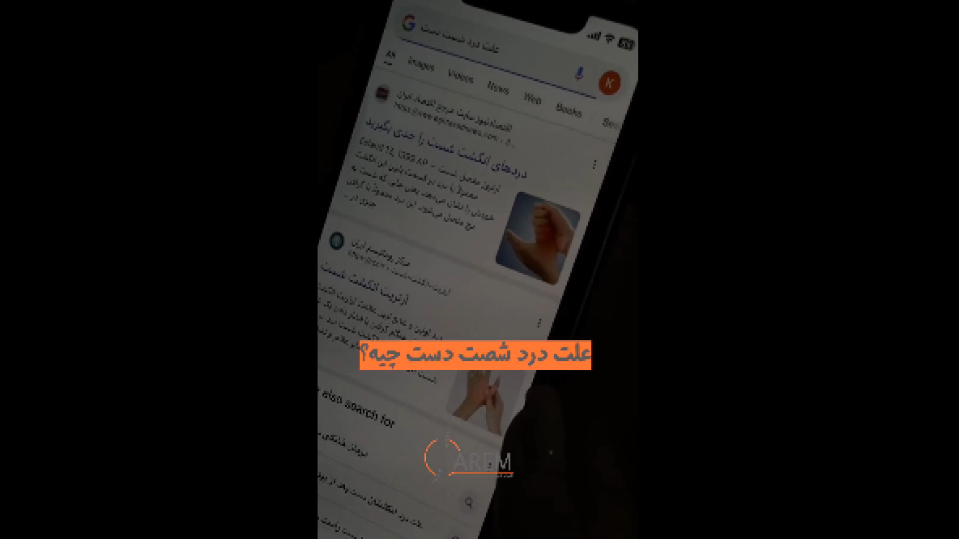 علت درد شست دست زاویه سازی صورت