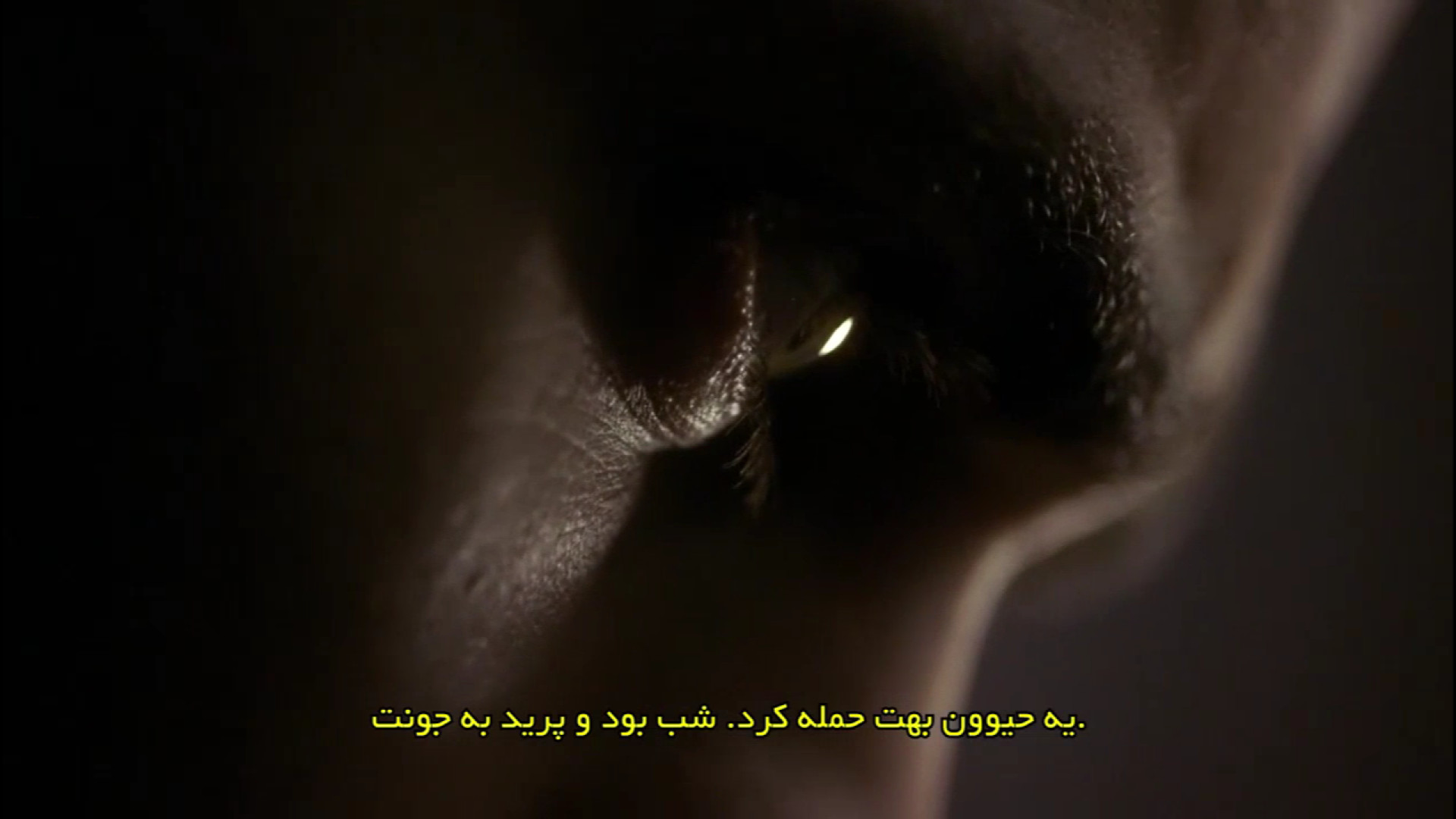 قسمت دوم فصل اول سریال خاطرات یک خون آشام مزوتراپی