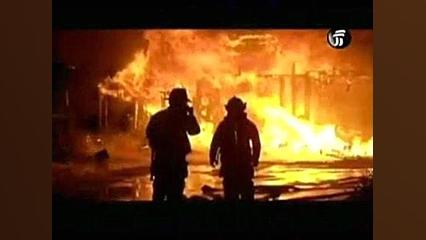 مستند دستگاه عصبی محیطی و مرکزی دندان شیری