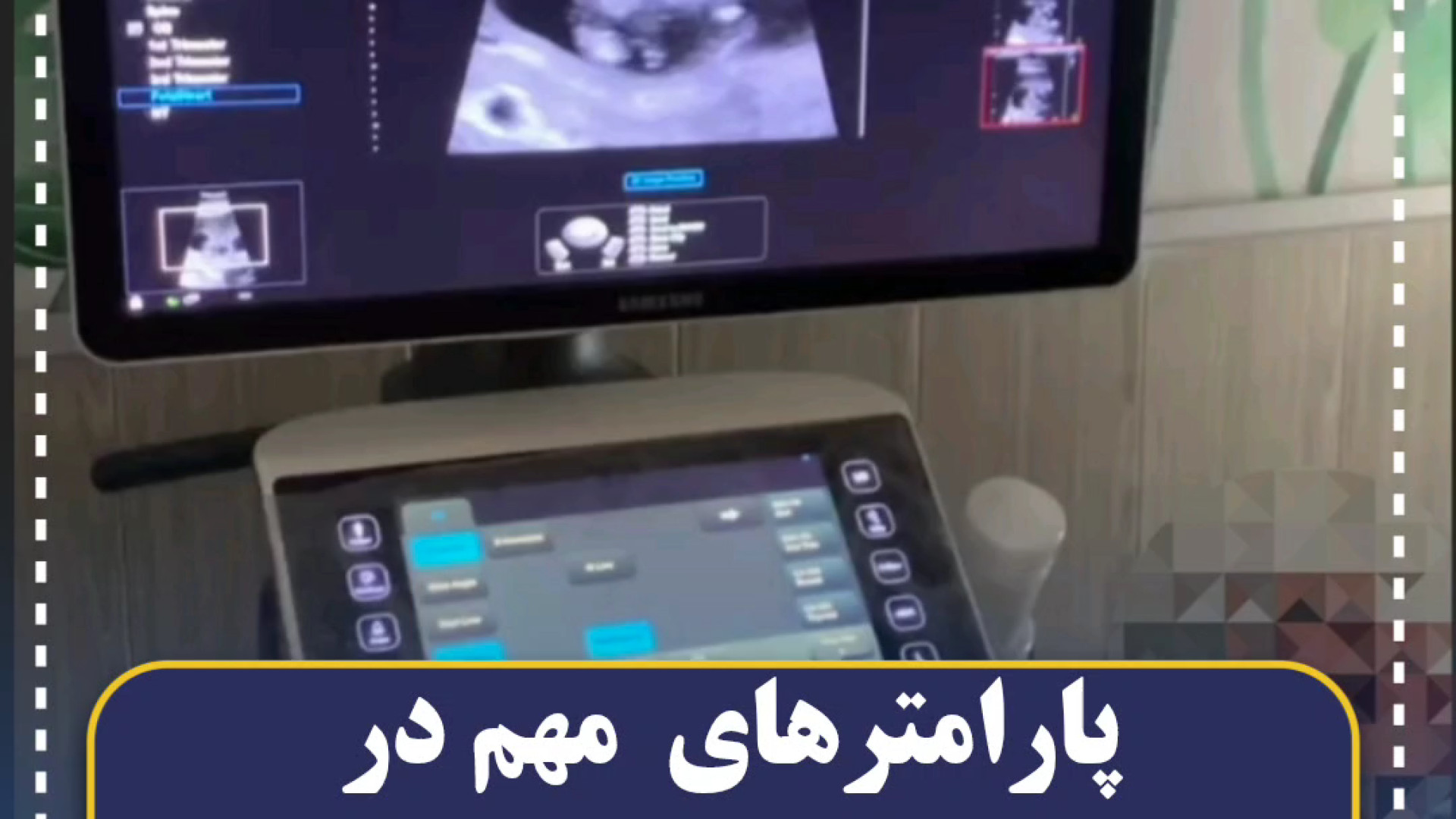 غربالگری اولیه بارداری (۱۱ تا ۱۳هفتگی) مرکز تصویربرداری دکتر مریم ابراهیمی، مبنا-تهران