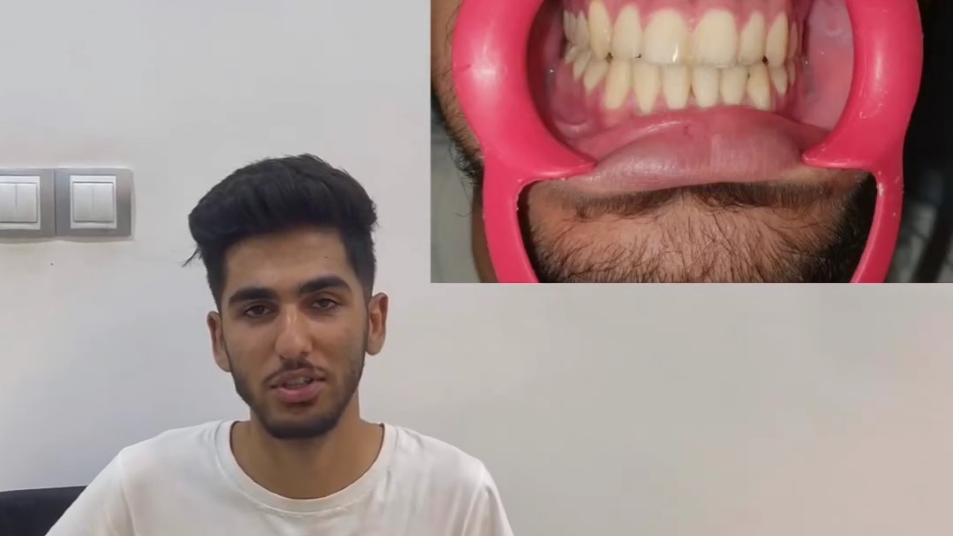 درمان ارتودنسی ثابت ، بدون جراحی فک و بدون کشیدن | دکتر ثریا یوسف نژاد دکتر ثریا یوسف نژاد متخصص ارتودنسی بابل