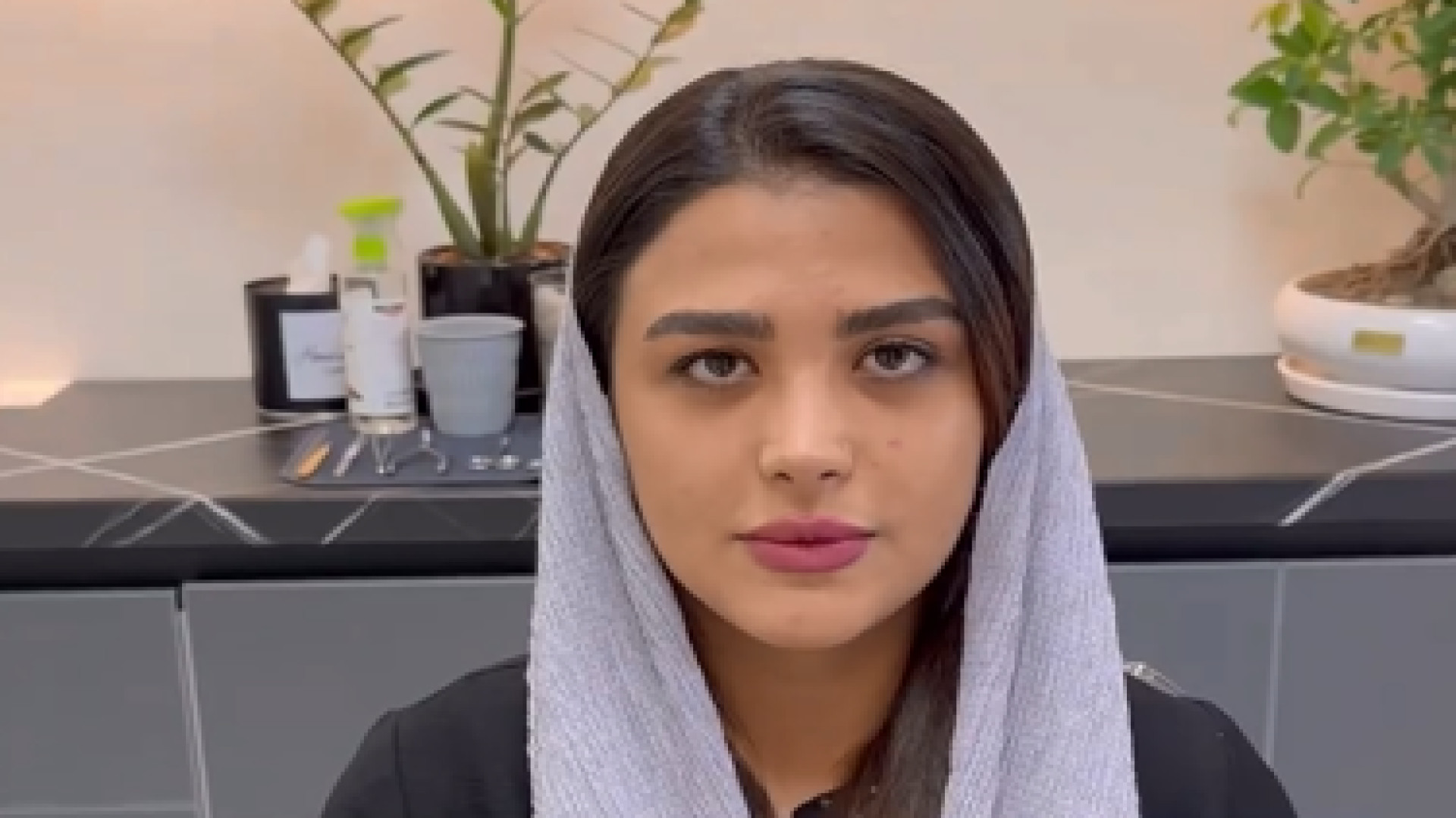 سه ماه و نیم بعد از عمل بینی گوشتی _ دکتر مهدی بنائی