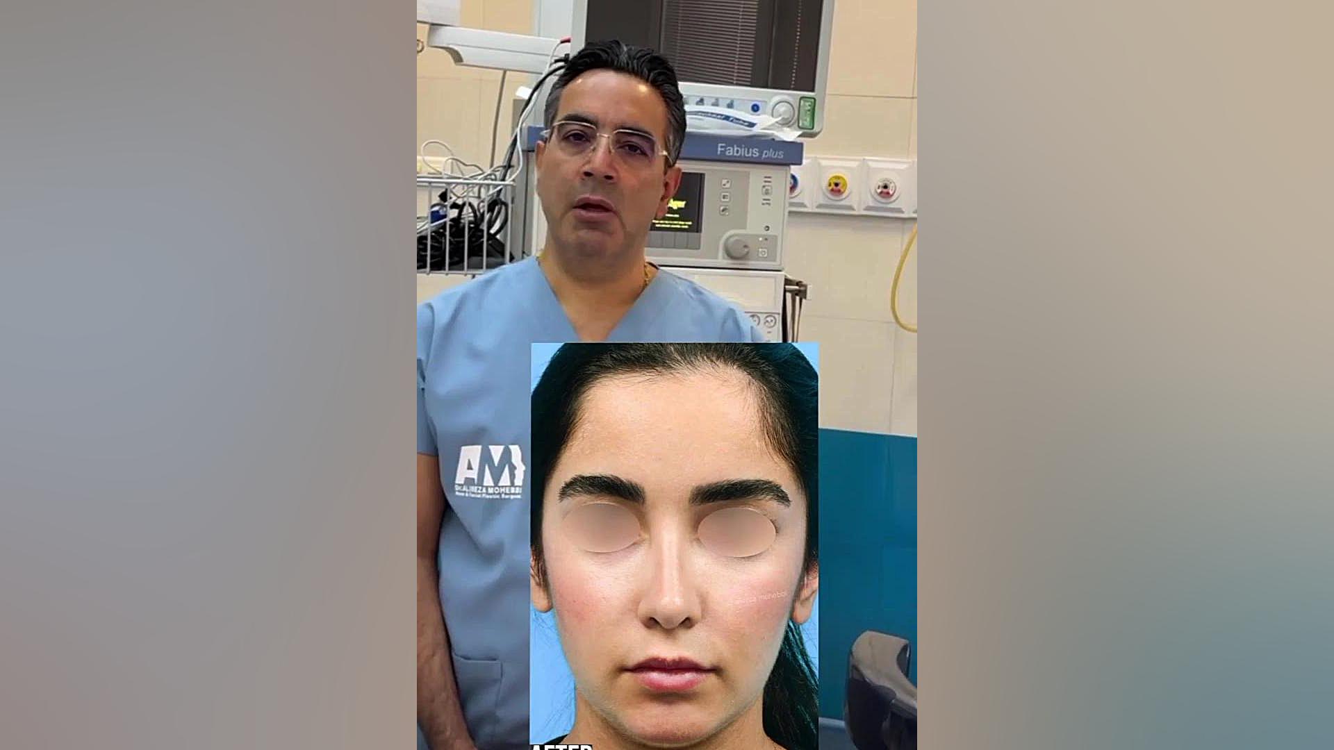 تغییرات سه رخ بینی و توصیه های دکتر محبی