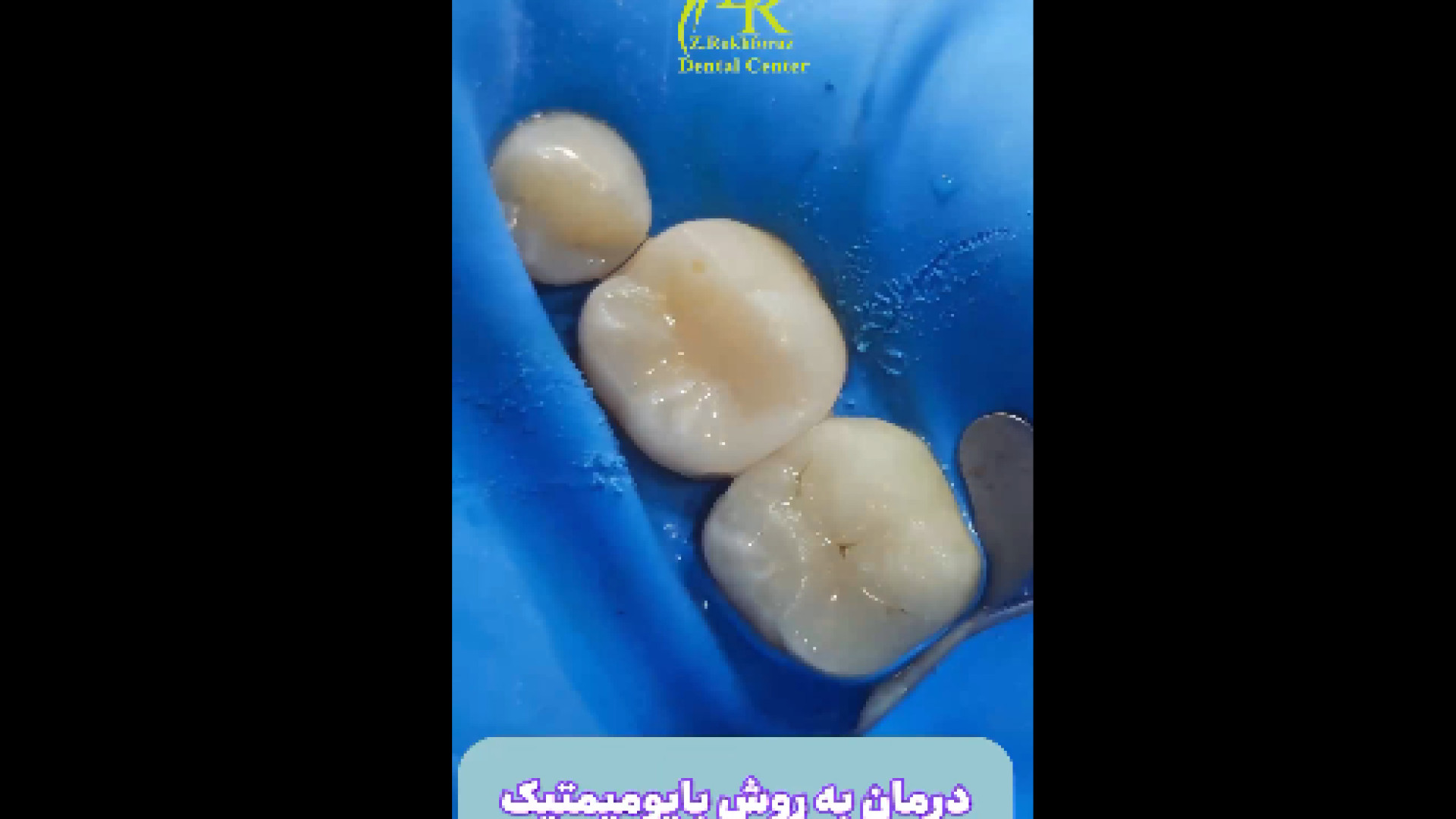 درمان به روش بایومیمتیک دکتر زهرا رخ فروز