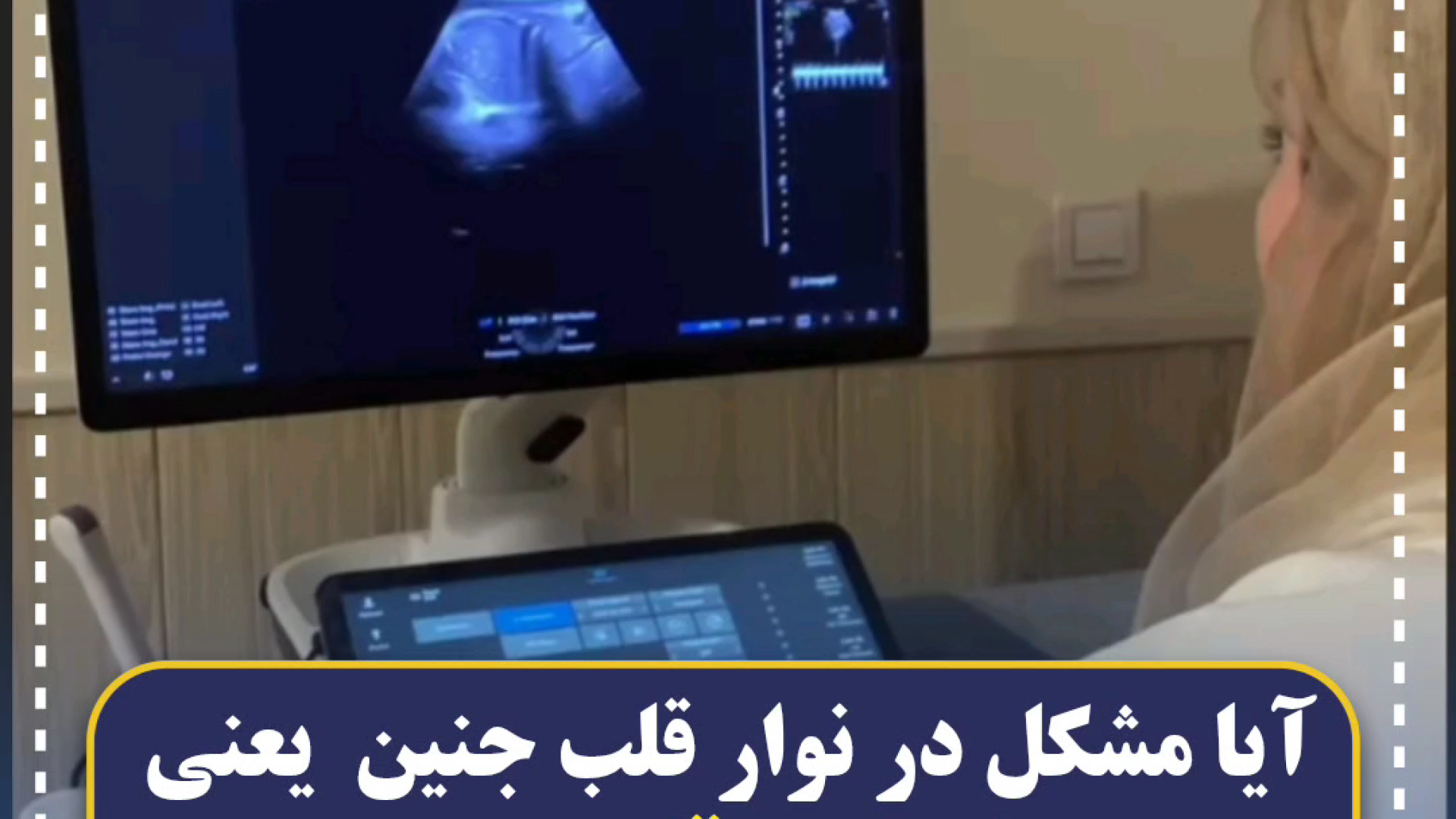 مشکل در نوار قلب جنین مرکز تصویربرداری دکتر مریم ابراهیمی، مبنا-تهران