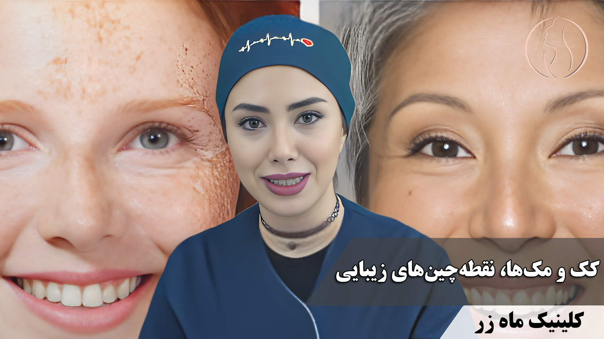 کک و مک‌ها ( هفته‌نامه شماره 2 کلینیک پوست، مو، و لیزر ماه زر ) بیماری دیستروفی لیمب-گیرل