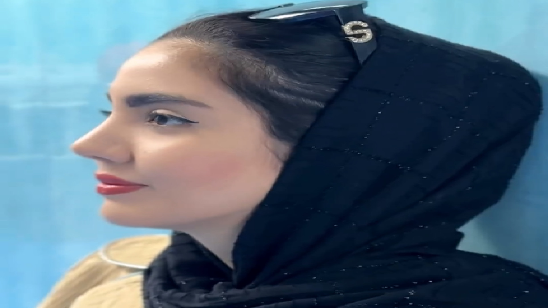 نتیجه نهایی جراحی به سبک طبیعی توسط دکتر علی عقیلی دکتر علی عقیلی - جراح بینی در تهران