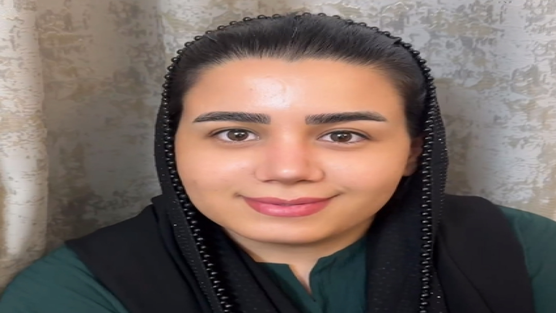 تحول زیبا در بینی گوشتی و دریافت نتیجه شگفت انگیز دکتر علی عقیلی - جراح بینی در تهران