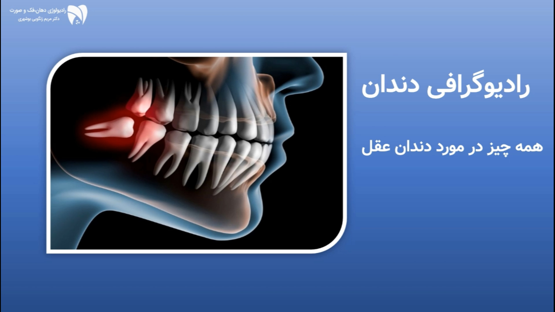 رادیوگرافی دندان - همه چیز در مورد دندان عقل رادیولوژی دهان، فک و صورت دکتر مریم زنگوئی بوشهری