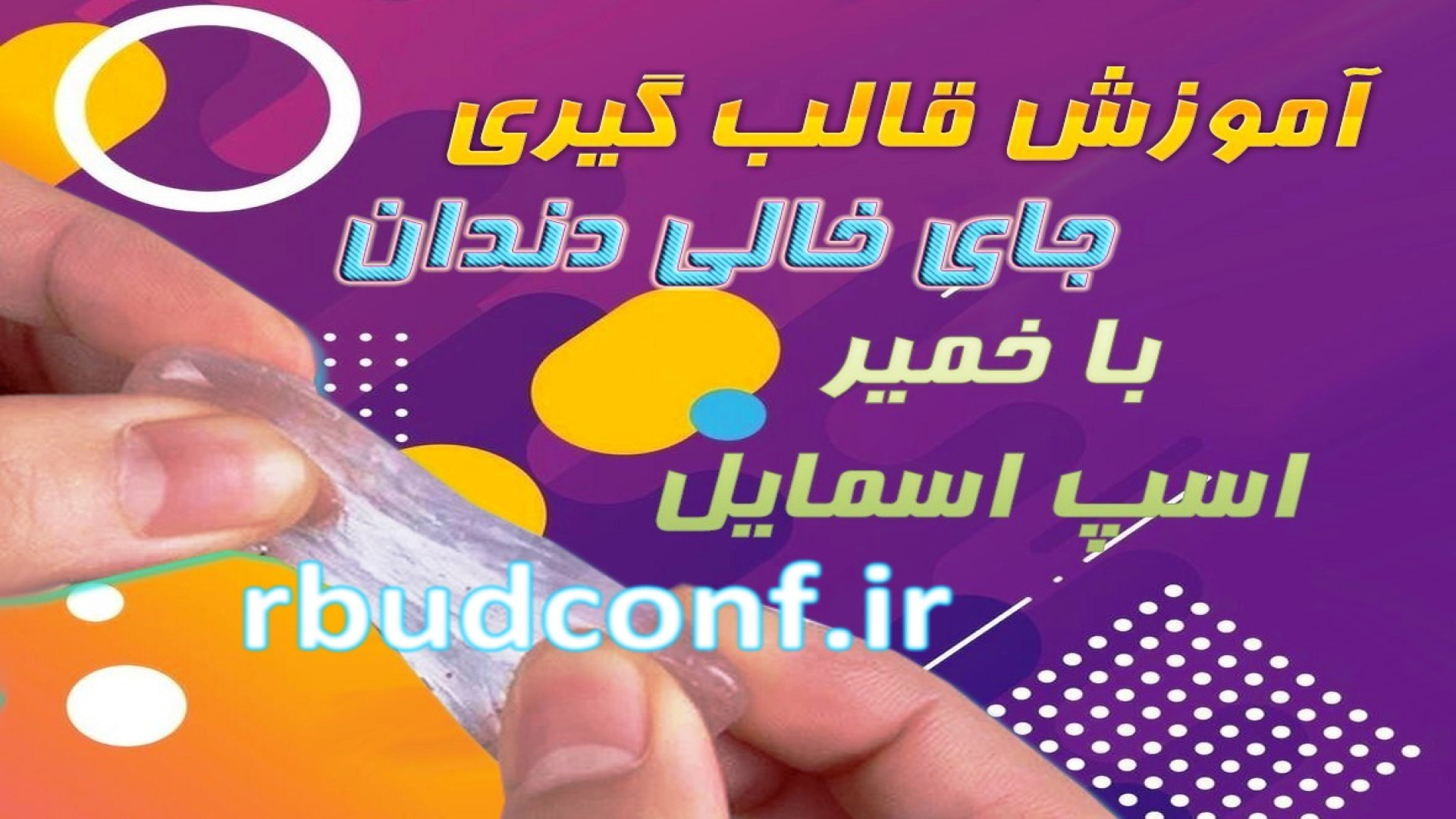 بهترین روش پر کردن جای خالی با خمیر لمینت متحرک دندان آتپازیب