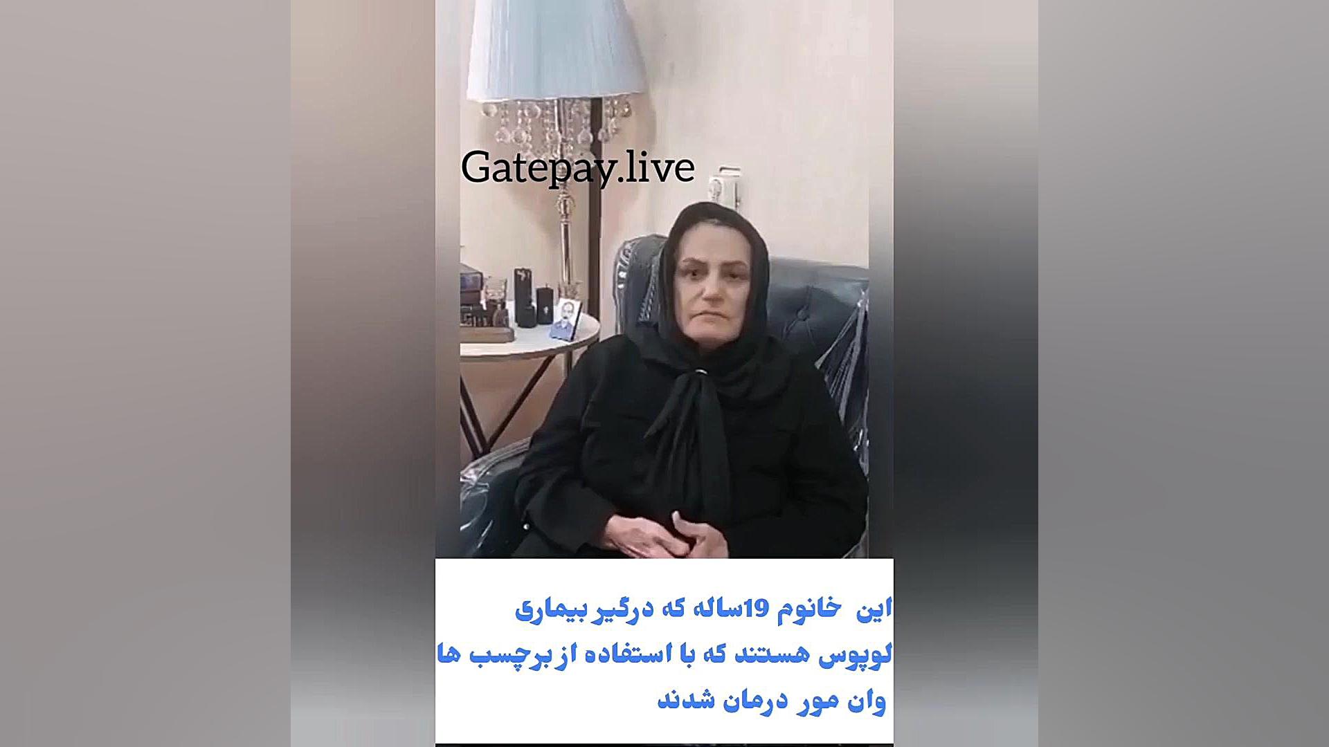 بیماری لوپوس اصلاح فرم صورت