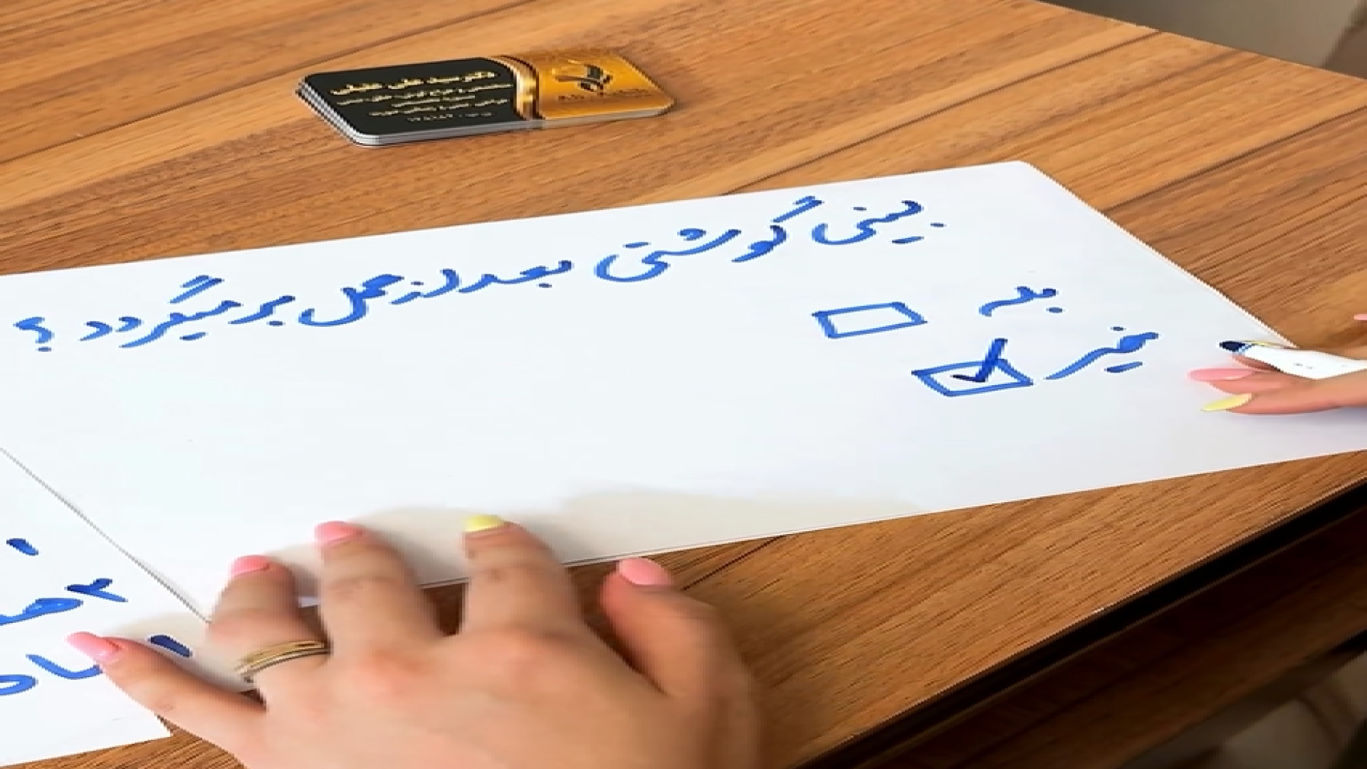 5 نکته در مورد عمل بینی - دکتر علی عقیلی دکتر علی عقیلی - جراح بینی در تهران