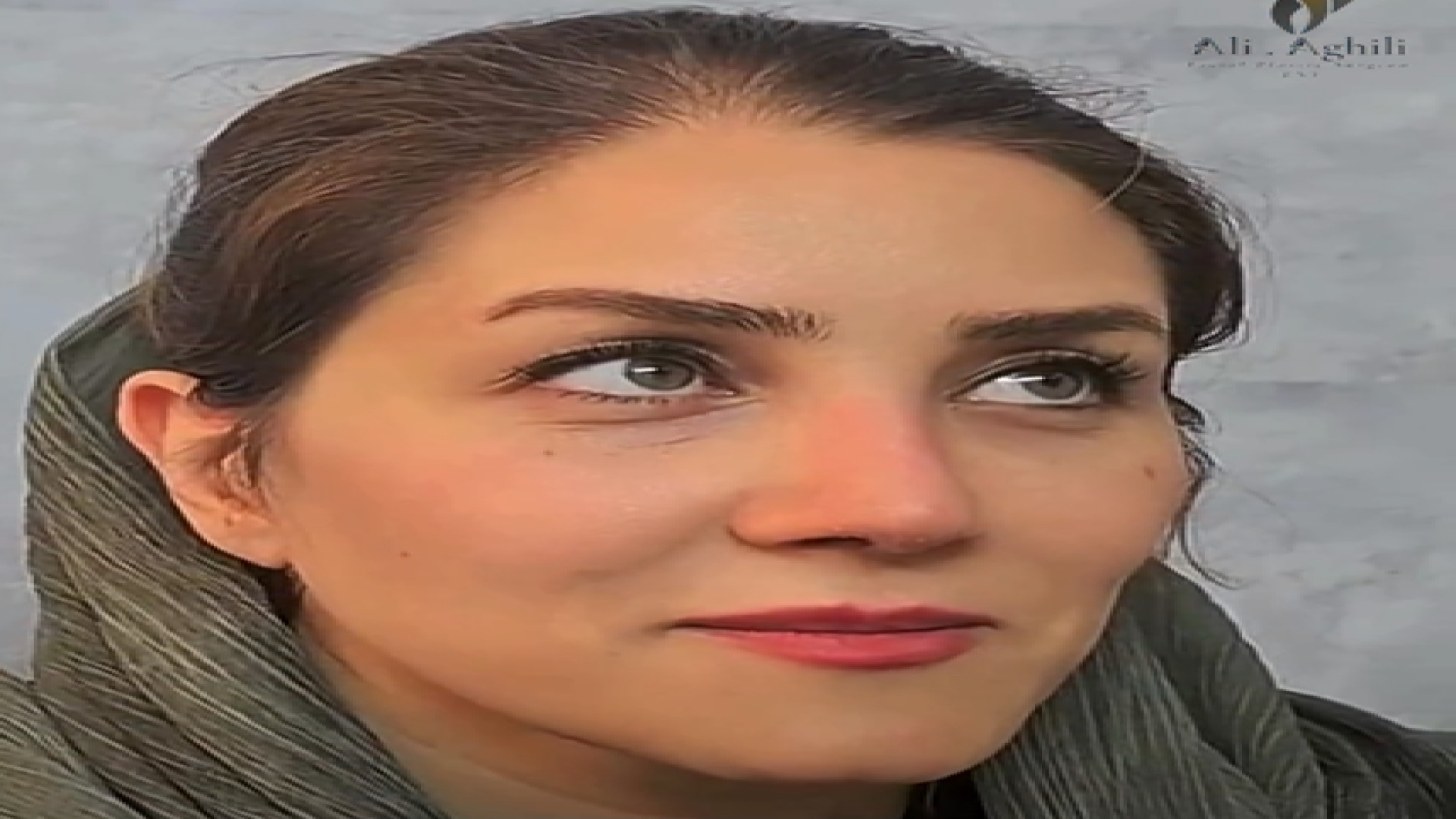 نتیجه عمل بینی به روش نچرال و طبیعی با دکتر عقیلی دکتر علی عقیلی - جراح بینی در تهران