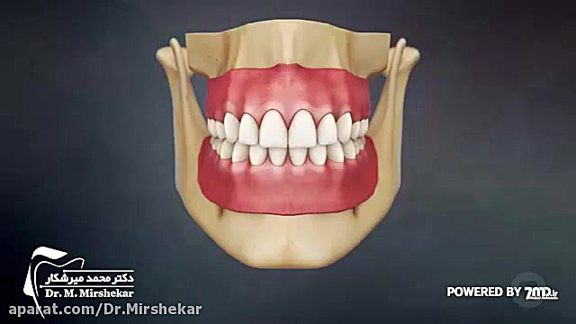 روکش دندان ترمیم زیبایی دندان