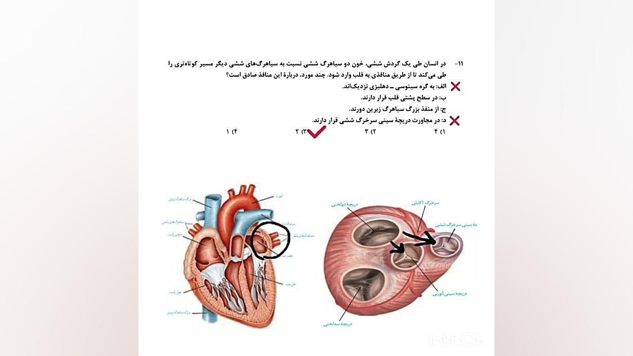 تحلیل تست «۱۱» کنکور زیست شناسی اردیبهشت ۱۴۰۳ تنبان گشاد