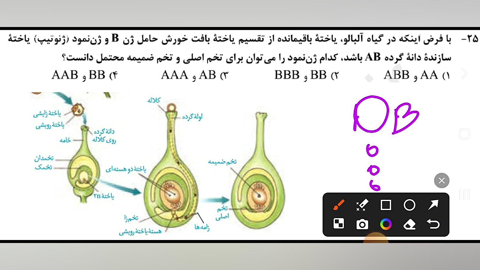 تحلیل تست «۲۵» کنکور زیست شناسی اردیبهشت ۱۴۰۳ لیفت گردنایمپلنت دندان
