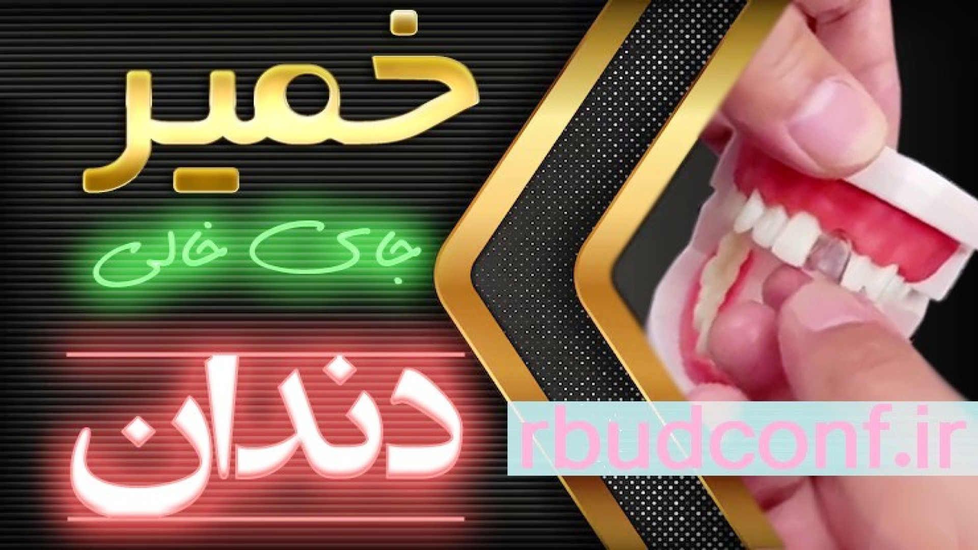 خمیر جادویی ترمیم کننده موقت دندان جلو South Moon 2024 پالبوسیکلیب