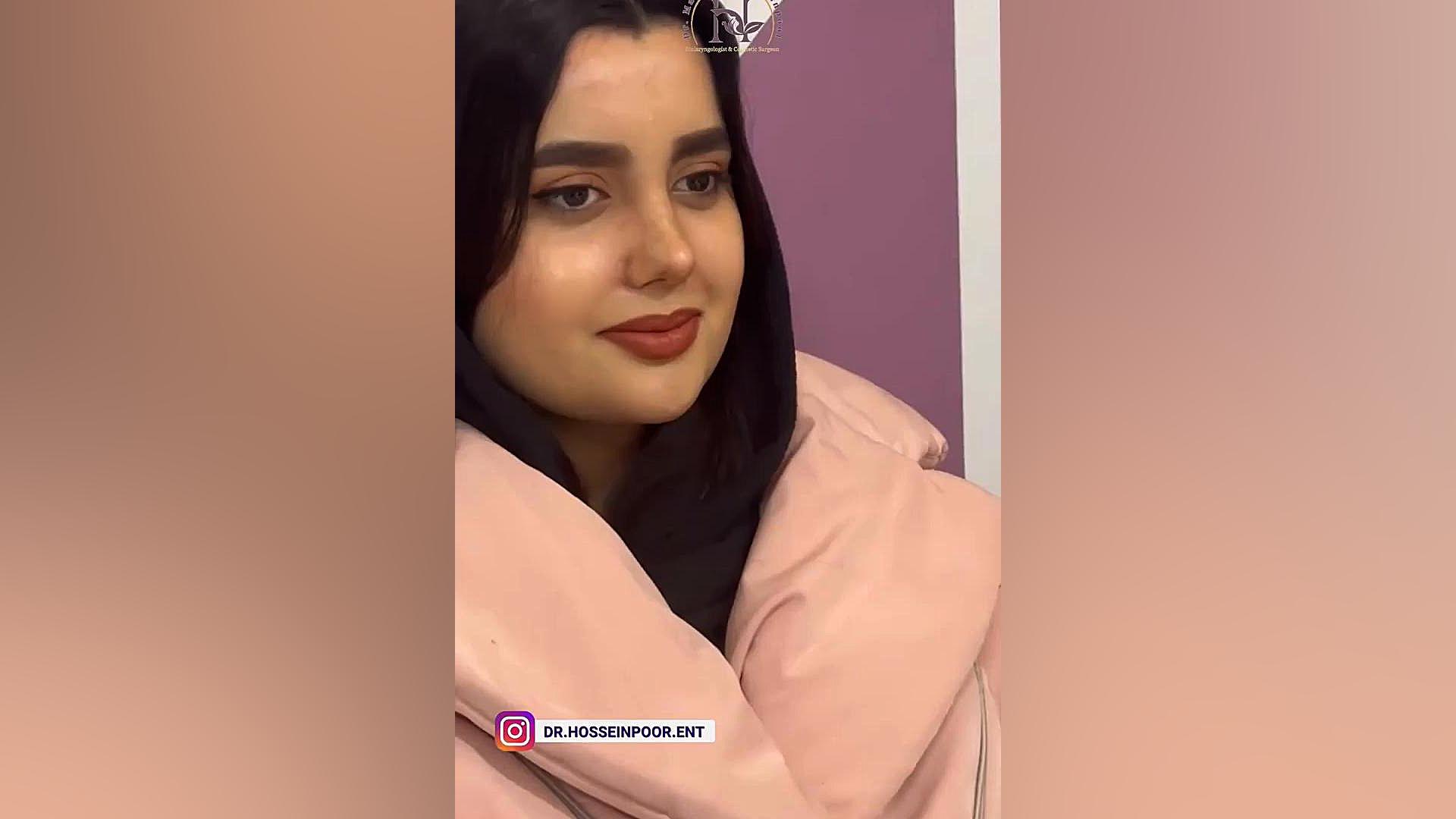 ترس از بیهوشی عمل بینی دکتر معصومه حسین پور