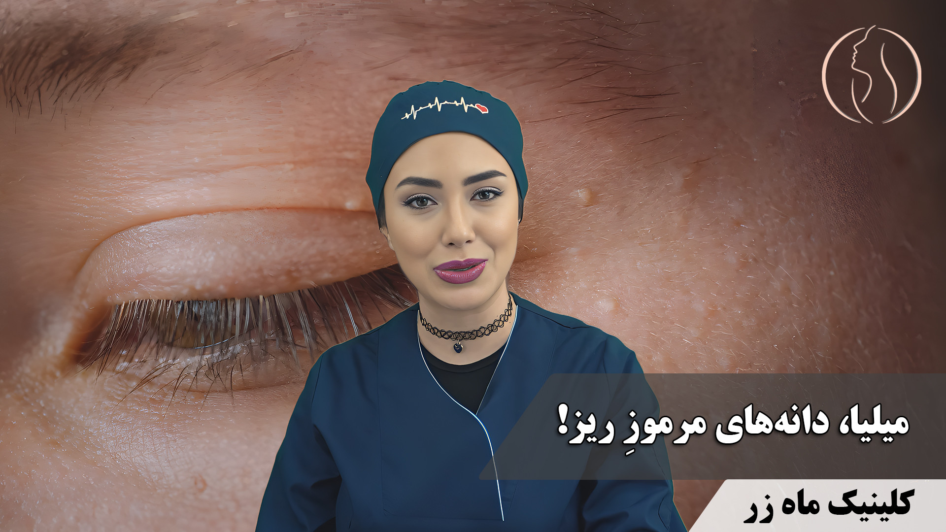 میلیا ( هفته‌نامه شماره 4 کلینیک پوست، مو، و لیزر ماه زر ) پرمترکسد