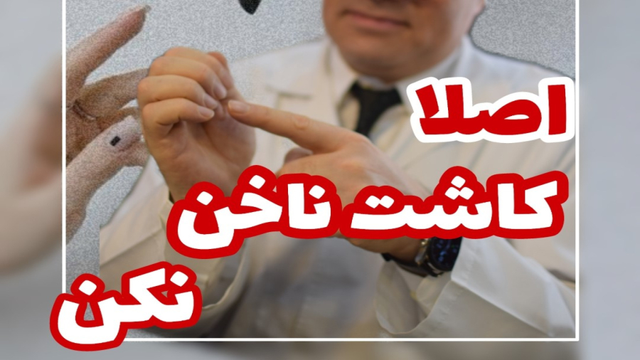 کاشت ناخن نکن