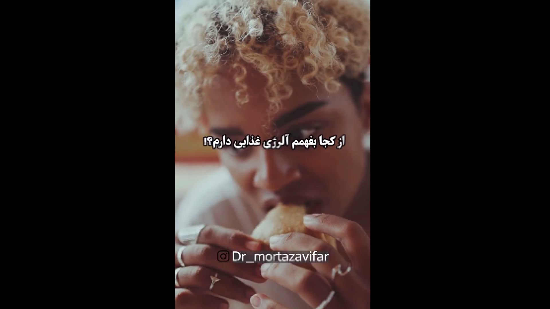 علائم آلرژی غذایی دکتر نسرین مرتضوی فر