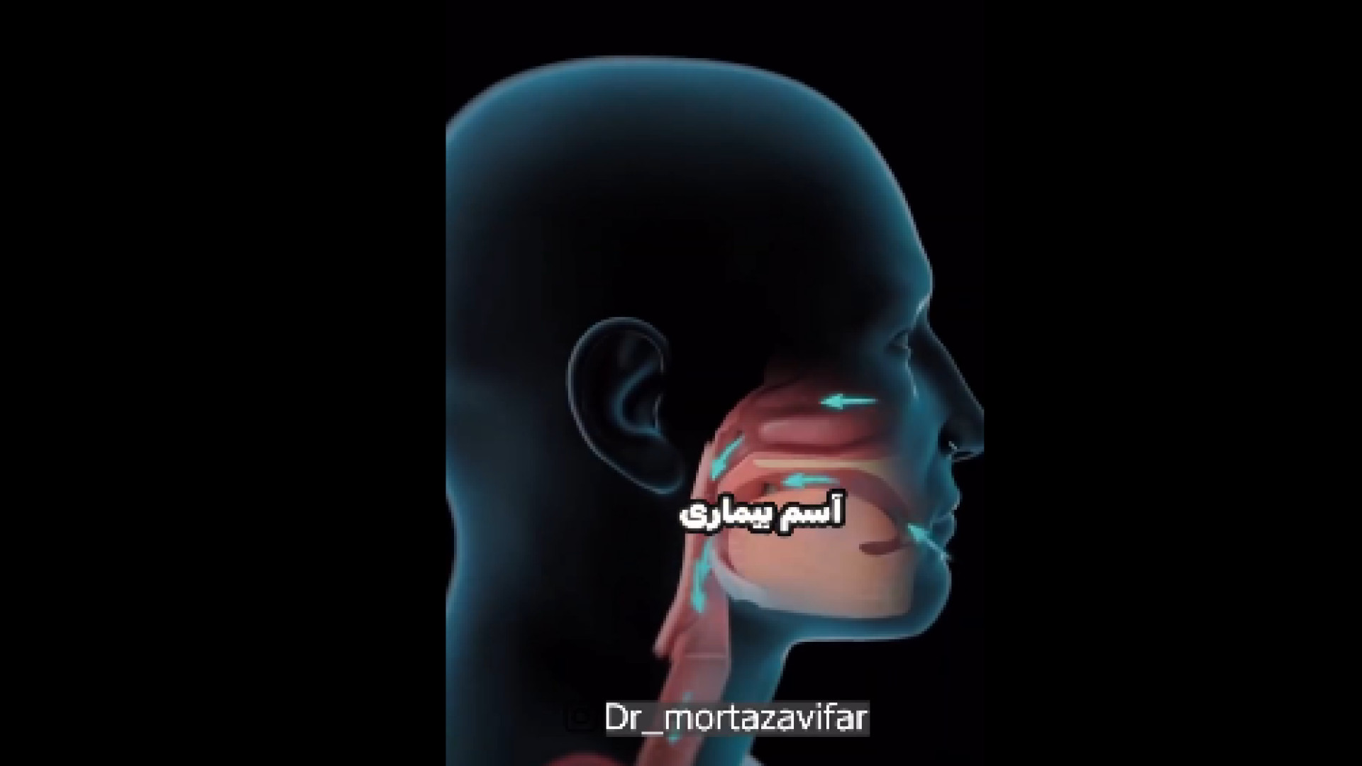عوامل تاثیرگذار بر آسم دکتر نسرین مرتضوی فر