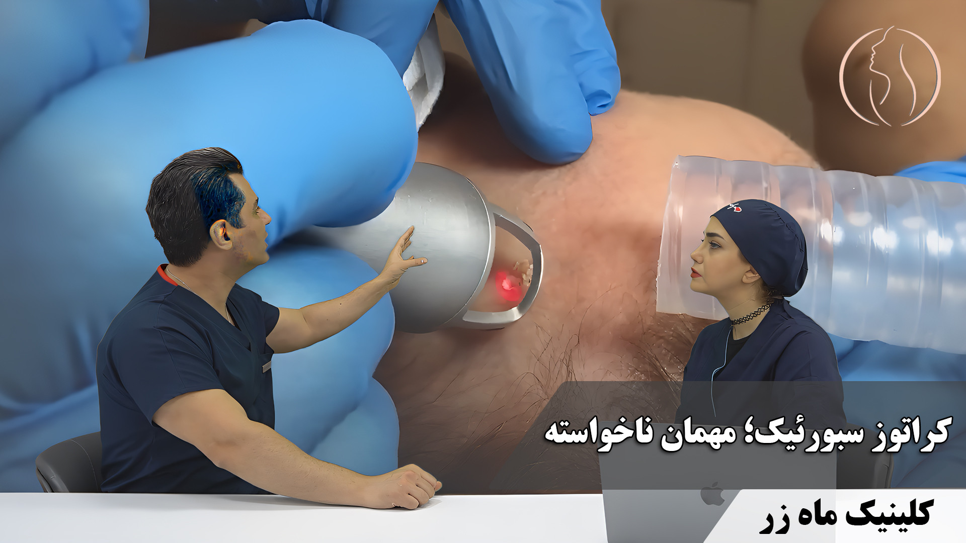 کراتوز سبورئیک ( هفته‌نامه شماره 5 کلینیک پوست، مو، و لیزر ماه زر ) پزشکی شخصی‌سازی‌شده سطح یاخته‌ای
