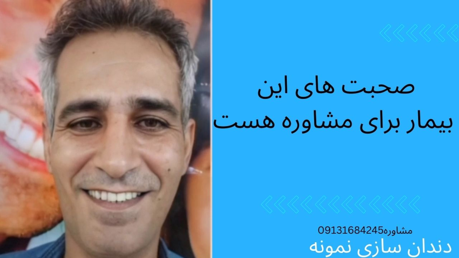 دندان مصنوعی پلاسماجت