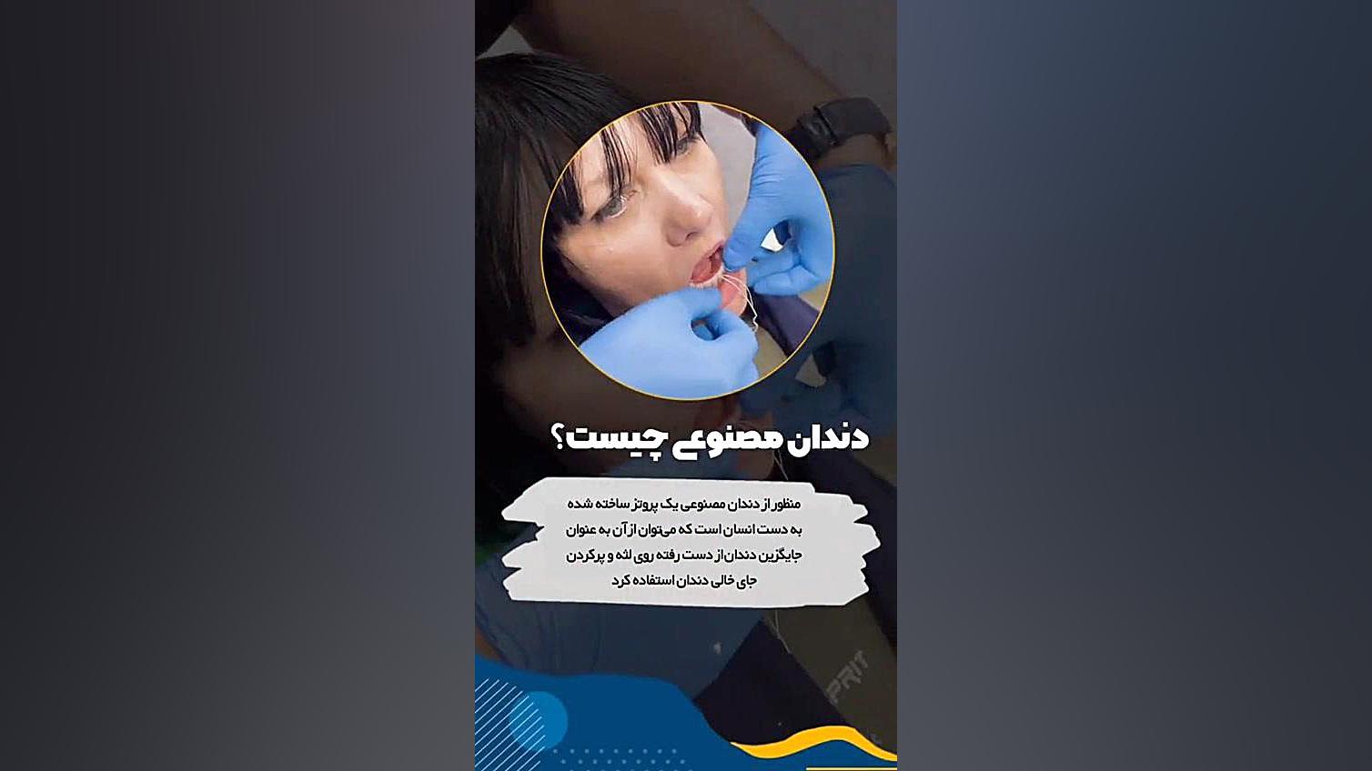 کاشت دندان مصنوعی ژله ای Organoid Viability Test