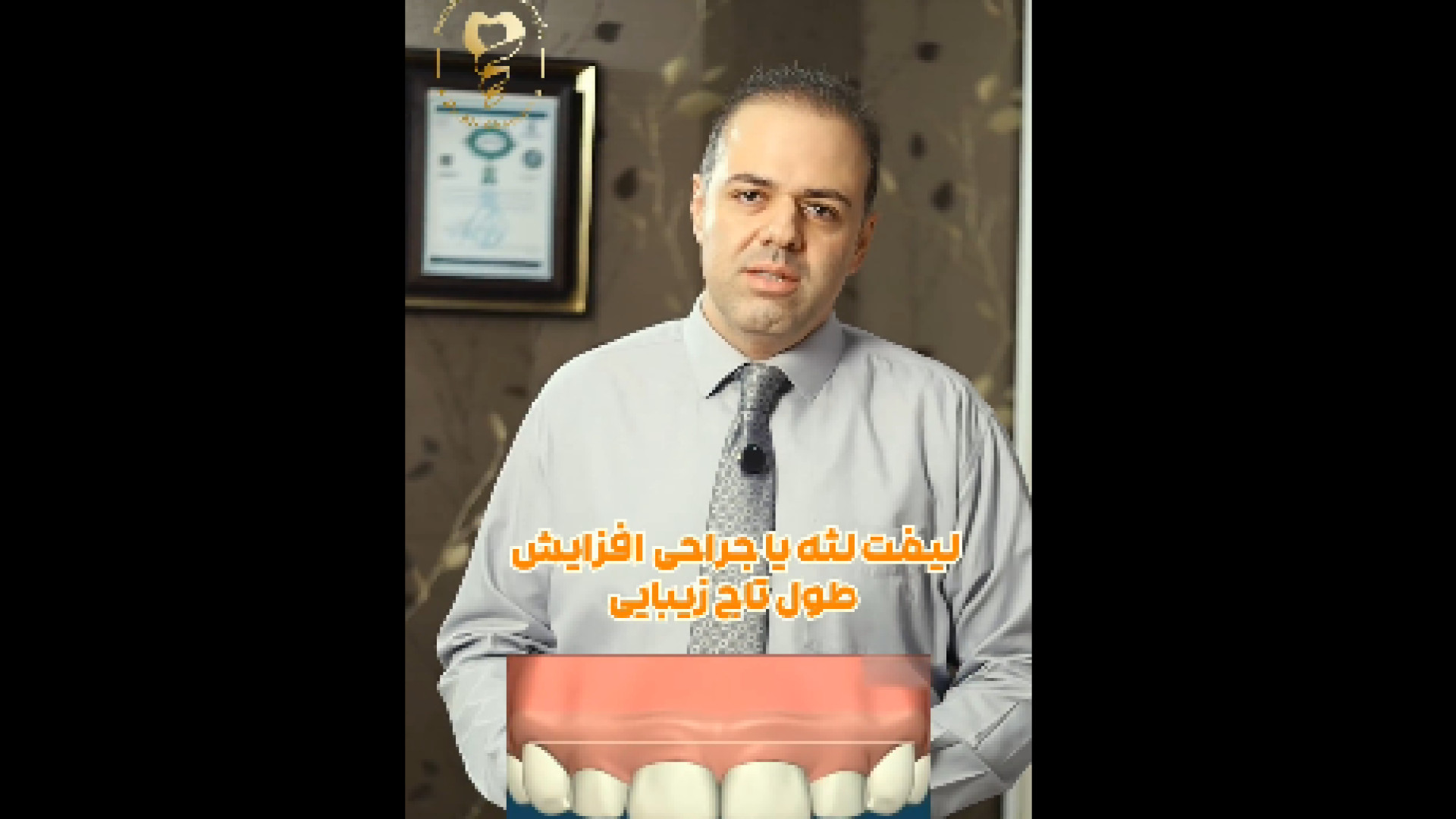 درمان لبخند لثه ای هیدروراکس