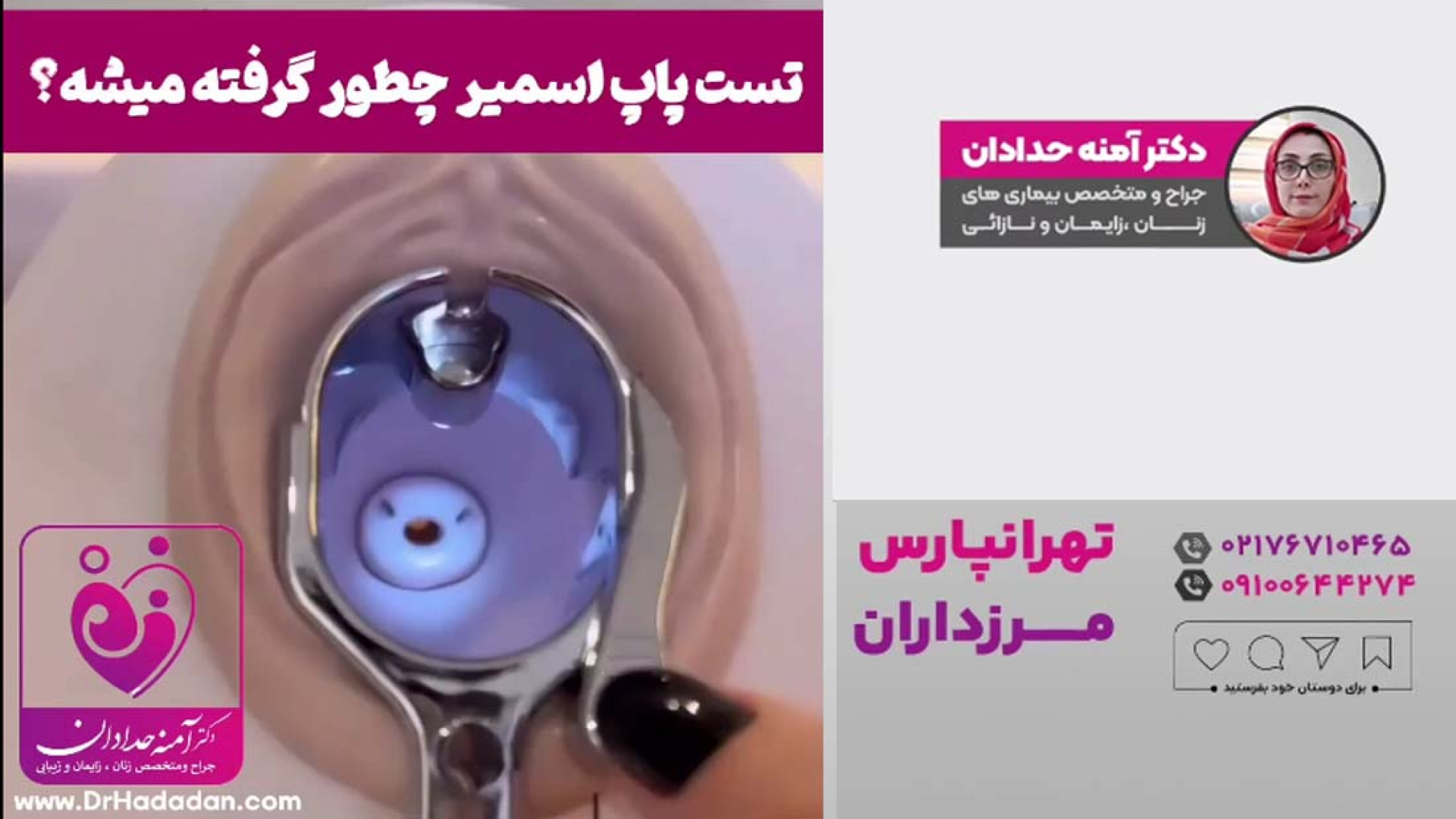 تست پاپ اسمیر چطور گرفته می شه ؟؟ دنزل واشینگتن