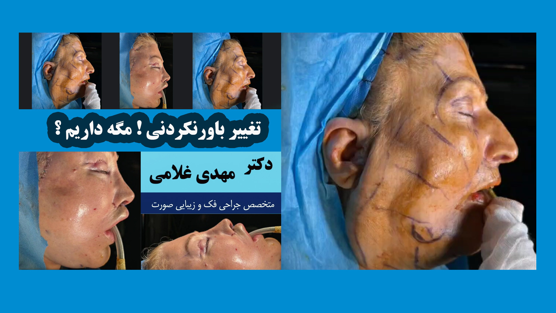 یک تغییر باورنکردنی !! دکتر مهدی غلامی