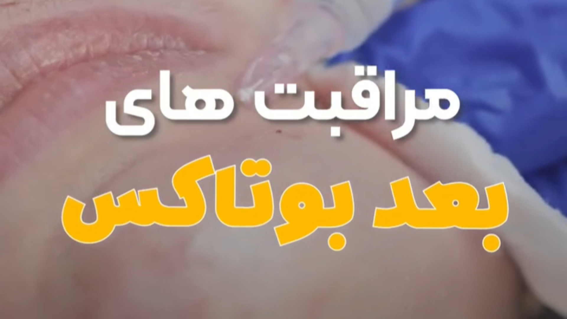 چه مراقبت هایی بعد از بوتاکس لازمه؟ دکتر مریم فرخشاهی - پوست، مو و زیبایی
