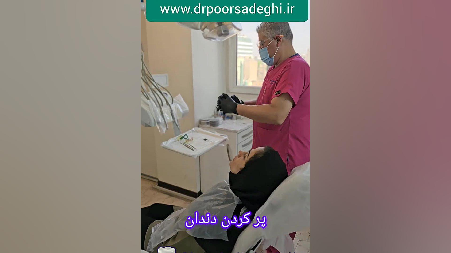 عصب کشی و روکش دندان در میدان پاستور تهران پرت و پلا