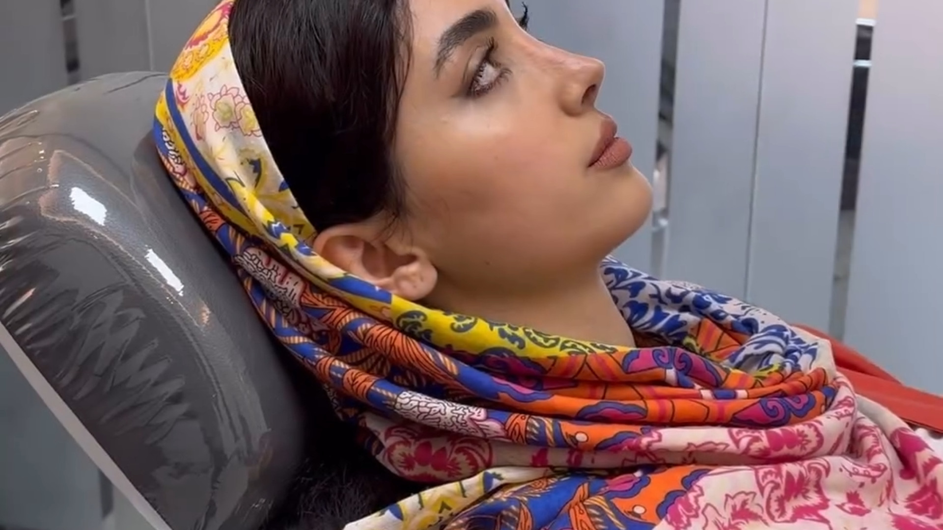 نتیجه ی زیبای عمل بینی بعد از 8 ماه