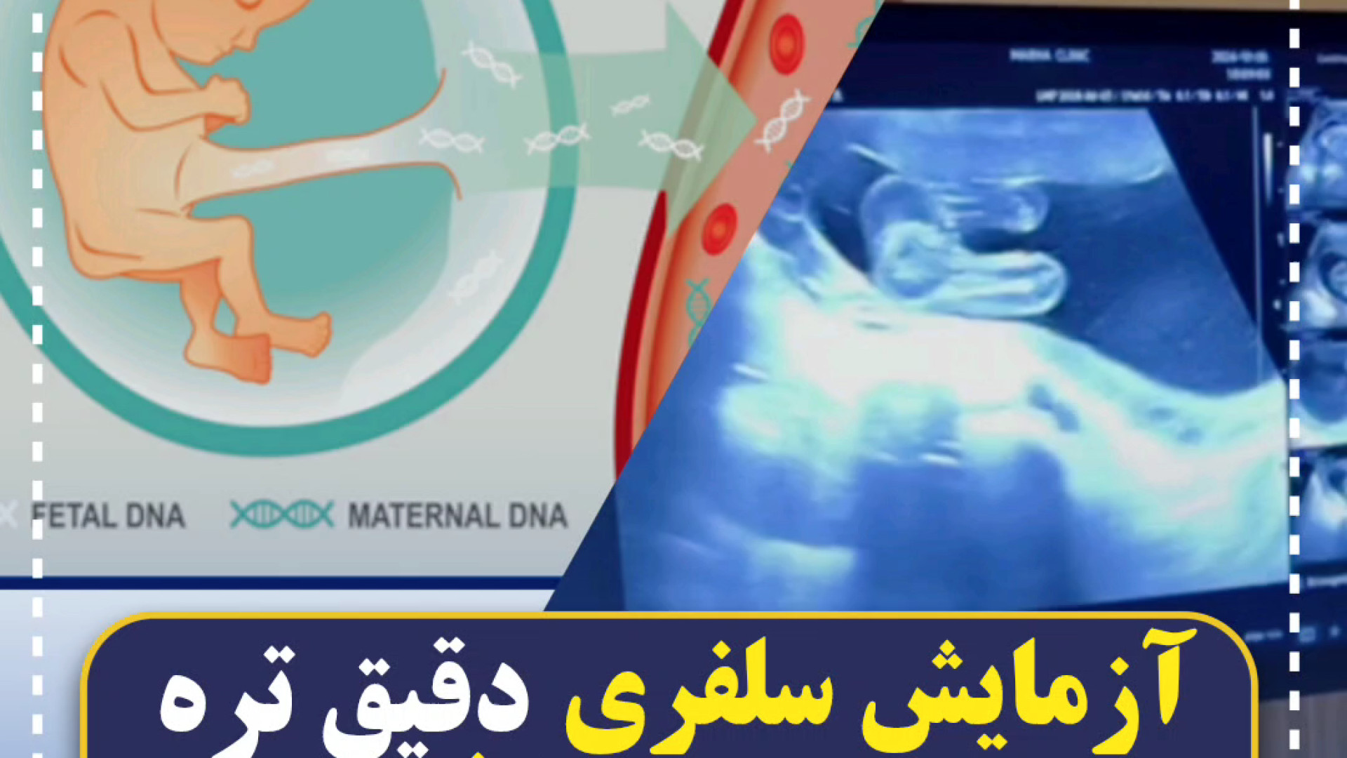 تعیین جنسیت با سلفری دقیق تره یا با سونوگرافی؟ مرکز تصویربرداری دکتر مریم ابراهیمی، مبنا-تهران