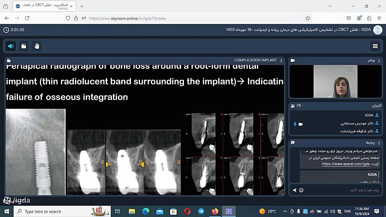 نقش CBCT در تشخیص کامپلیکیشن های درمان ریشهو ایمپلنت-18مهر1403بخش 2 رزولین