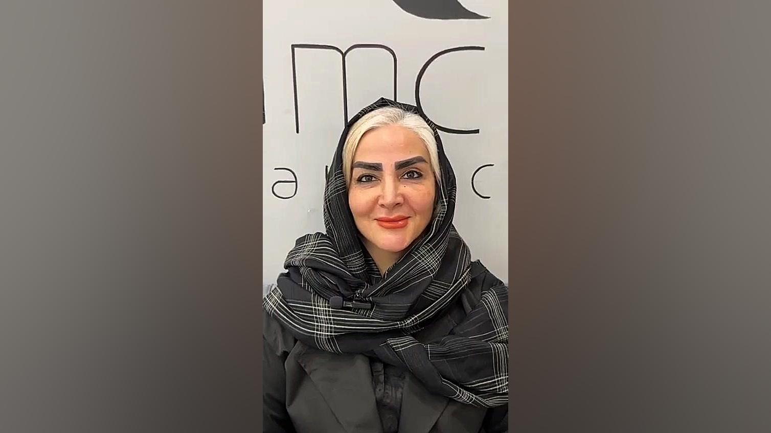 کاشت ابرو در کلینیک پوست و مو پامچال پتوز دوطرفه