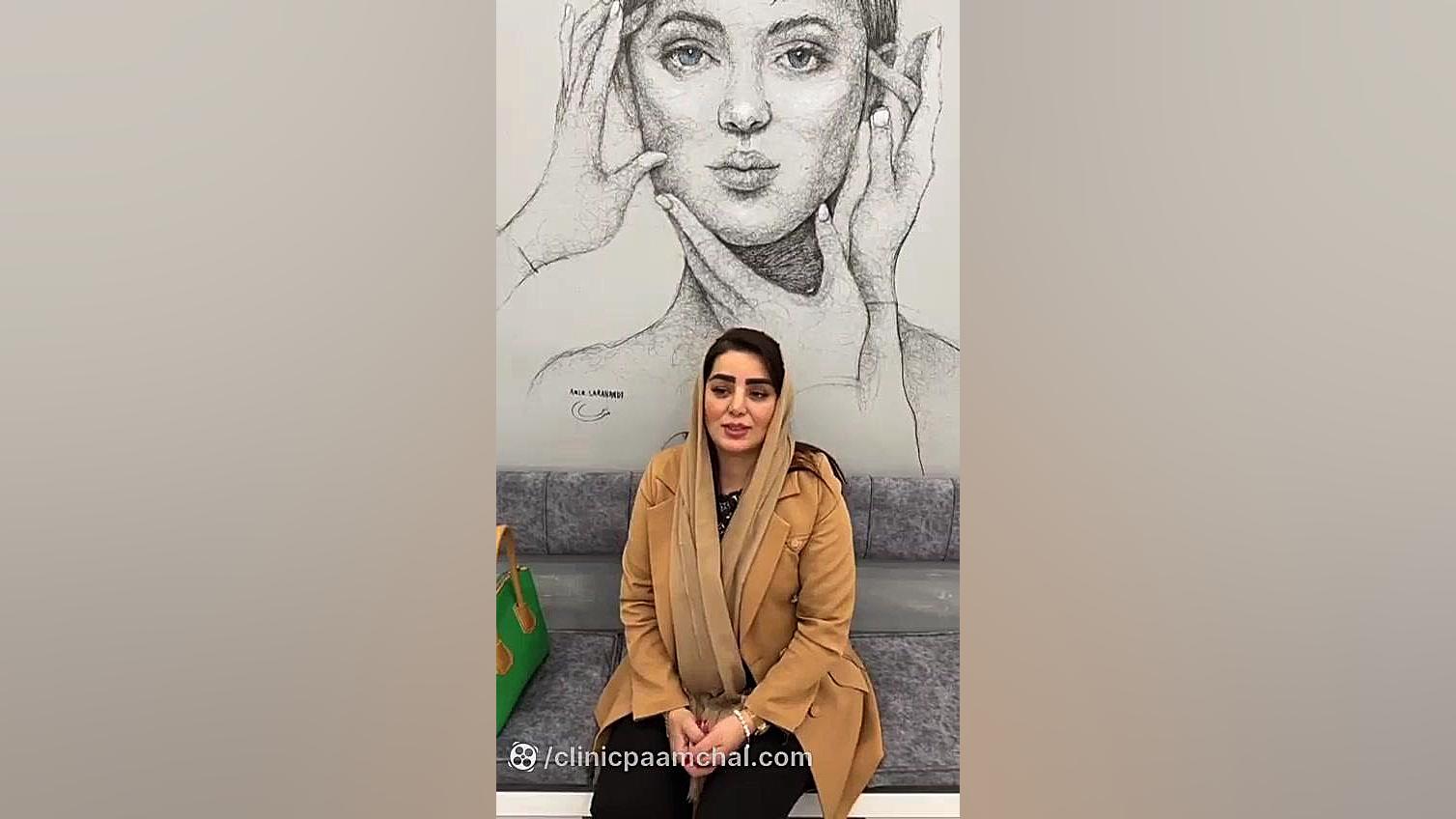 کاشت ابرو در کلینیک پوست و مو پامچال بیماری سندروم آلاژیل