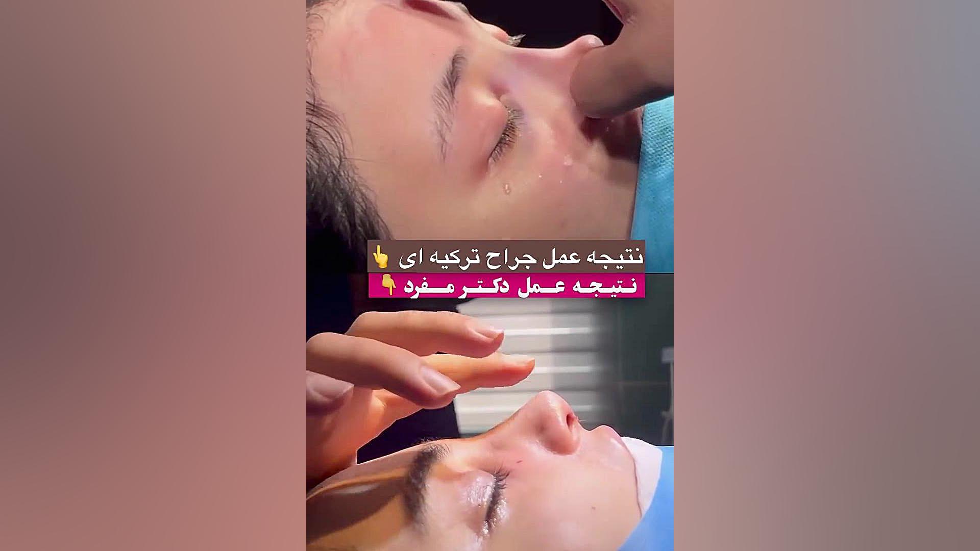 تفاوت جراحی ایران و ترکیه دکتر حمیدرضا مفرد