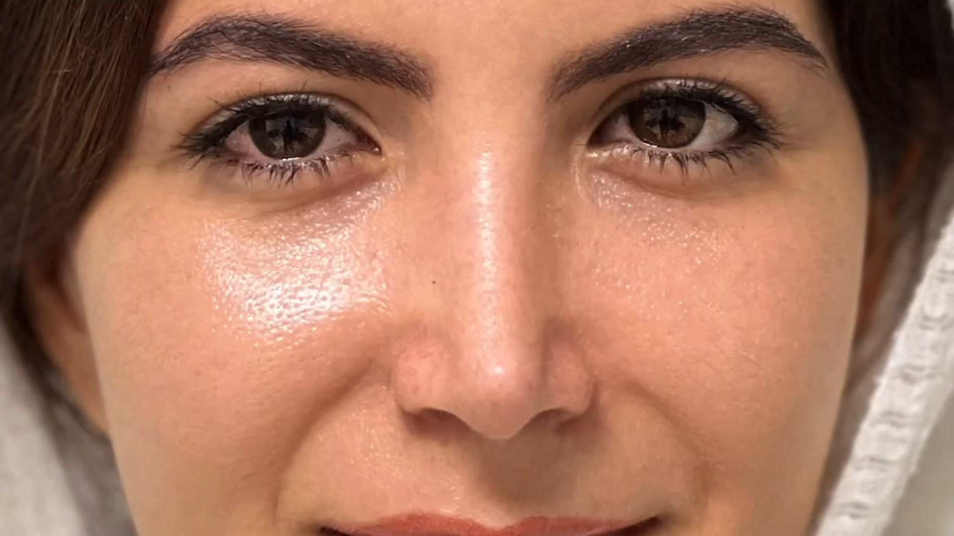 جراحی زیبایی توسط دکتر مفرد دکتر حمیدرضا مفرد