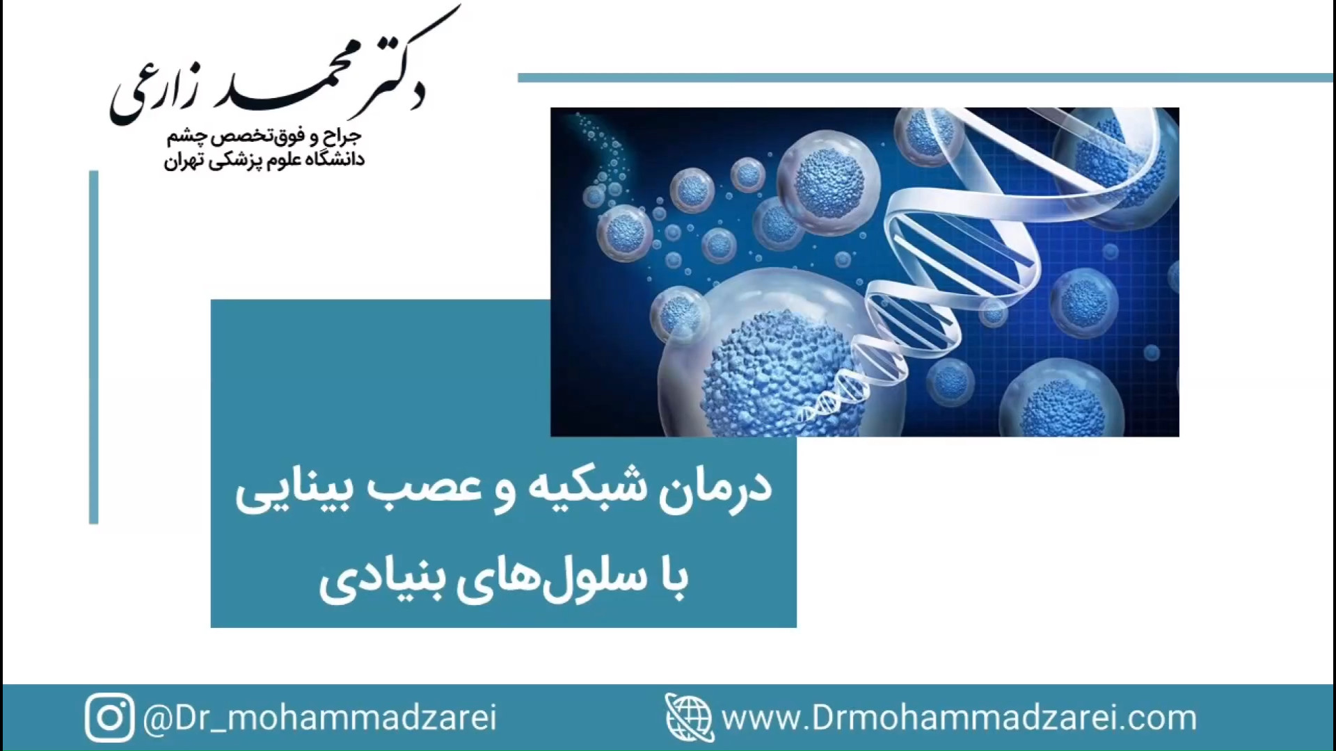 درمان شبکیه و عصب بینایی با سلول های بنیادی محسن چاوشی