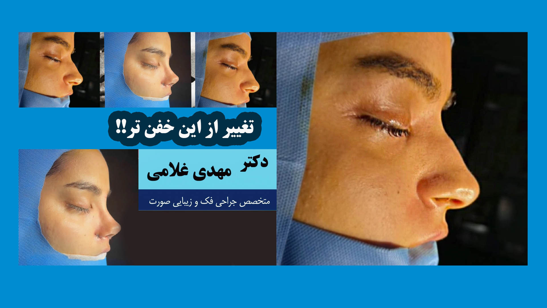 یک تغییر خفن دکتر مهدی غلامی