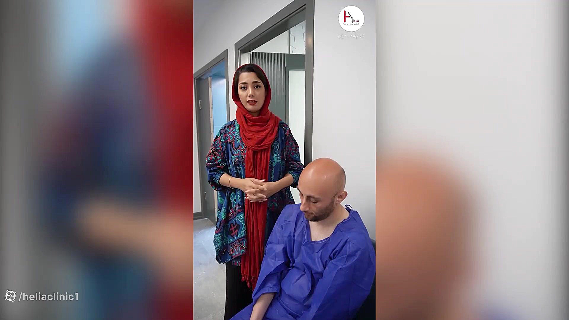 کاشت مو برای افراد طاس: راهکار تضمینی بدون نیاز به بانک مو کلینیک زیبایی