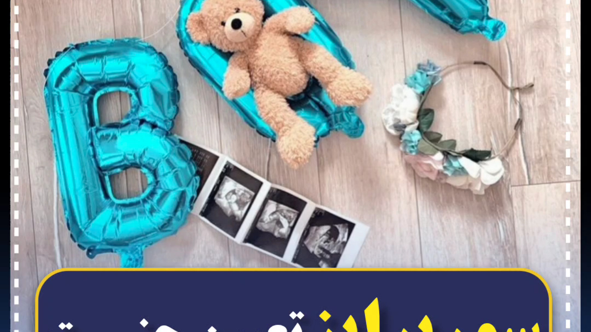 سورپرایز تعیین جنسیت در مرکز سونوگرافی مبنا مرکز تصویربرداری دکتر مریم ابراهیمی، مبنا-تهران