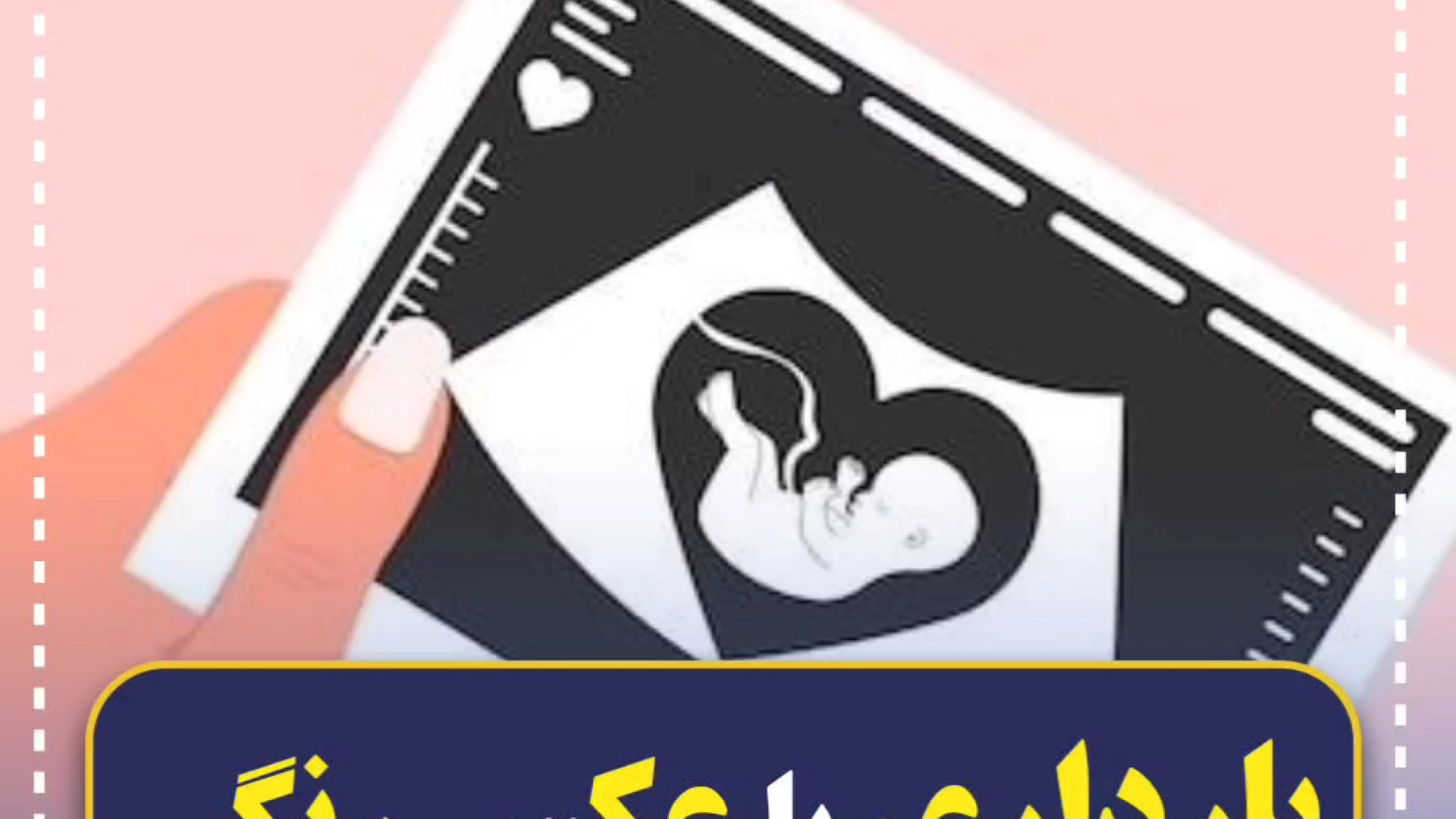 بارداری بعد از عکس رنگی رحم مرکز تصویربرداری دکتر مریم ابراهیمی، مبنا-تهران