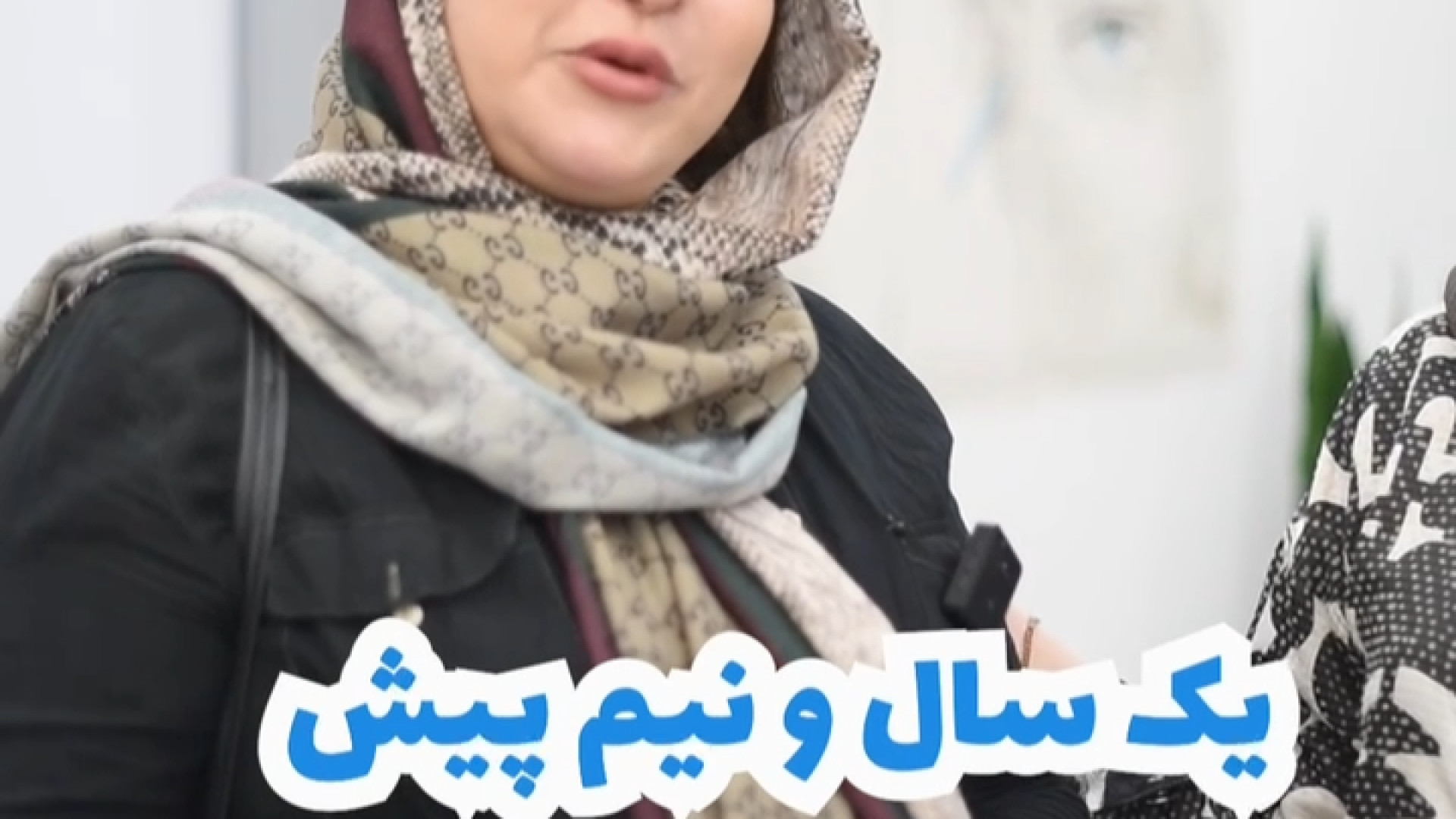 کاشت ابرو در سعادت آباد - کلینیک پوست و مو پامچال ChIP-Chip