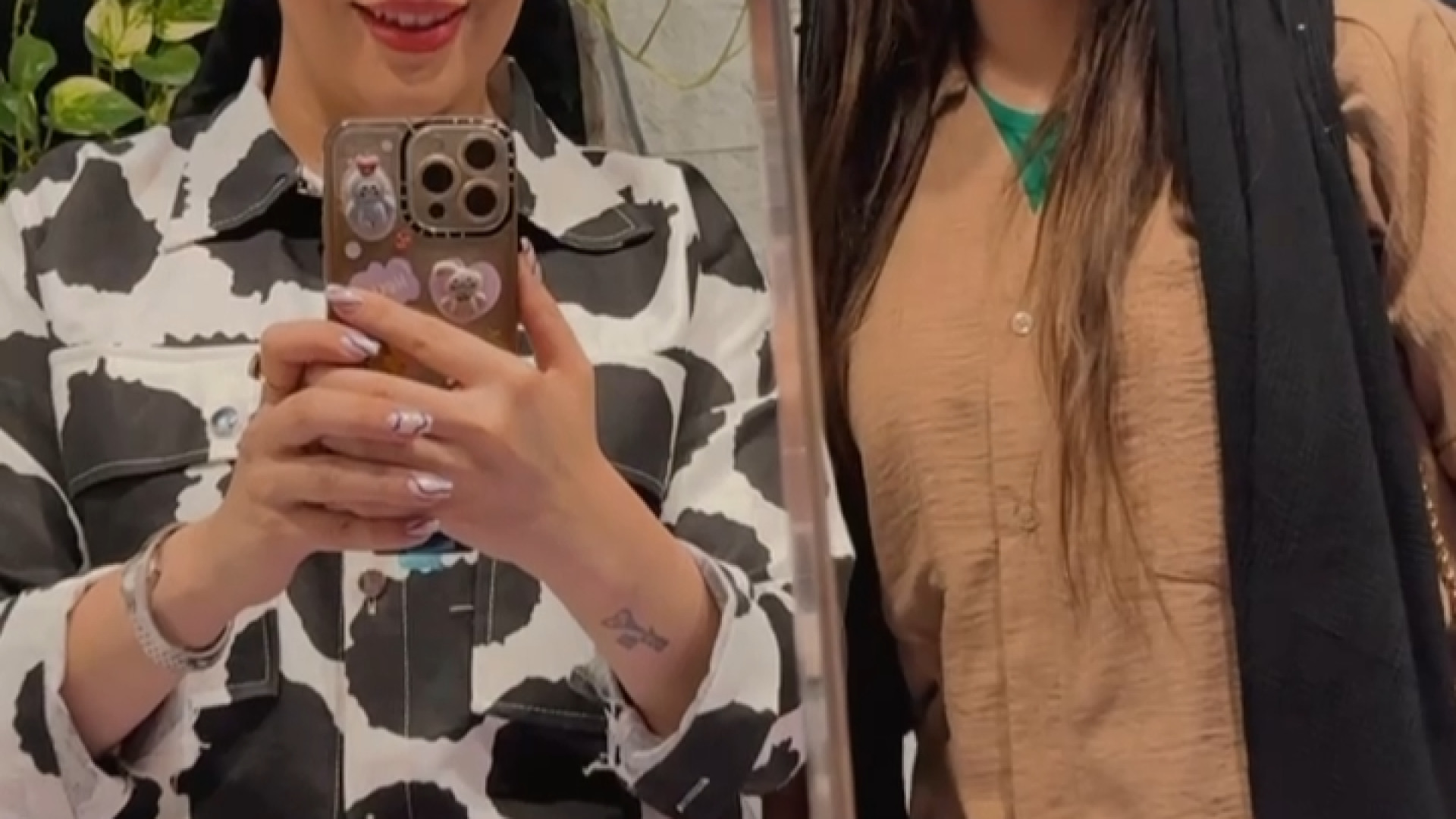 کاشت ابرو در سعادت آباد - کلینیک پوست و مو پامچال پتوز دوطرفه