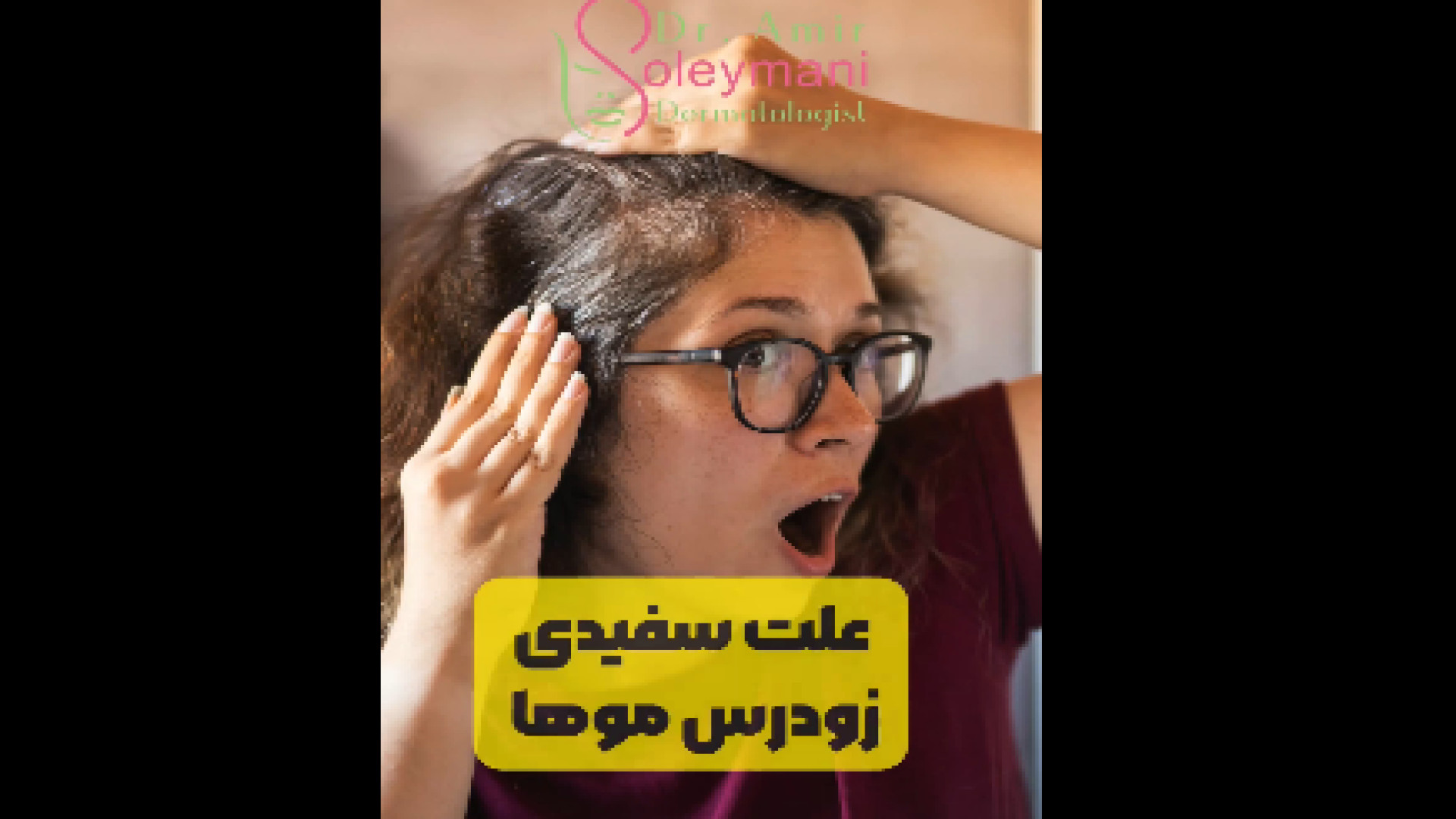 علت سفید شدن موی سر دکتر امیر سلیمانی